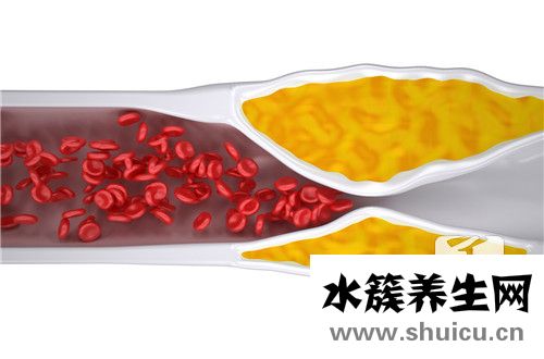 直接膽紅素偏高的原因