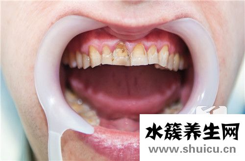 牙黃怎么辦