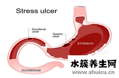 腸套疊癥狀