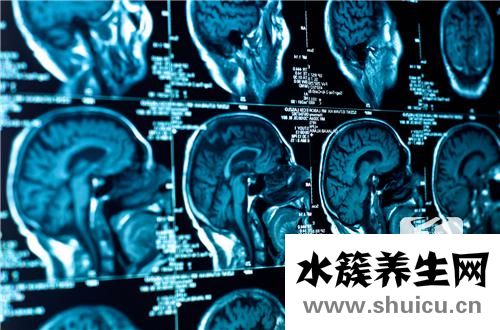 垂體瘤