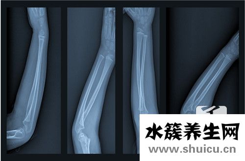 橈骨