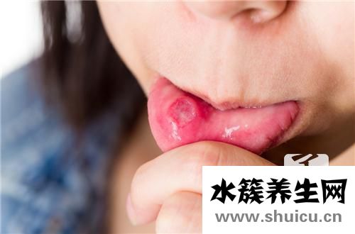 水皰