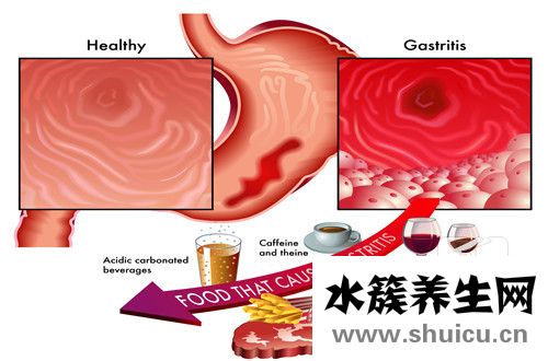 胃脹怎么辦
