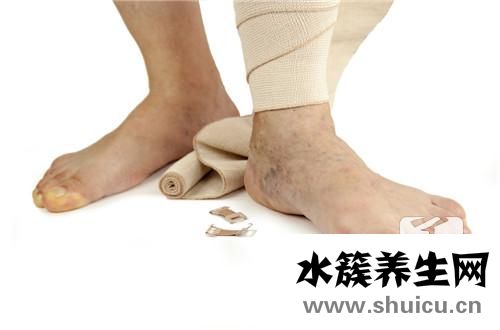 肢體不協調
