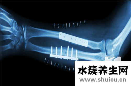橫突骨折