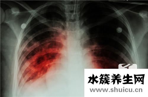 結核抗體檢測