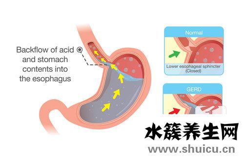 胃鏡是什么