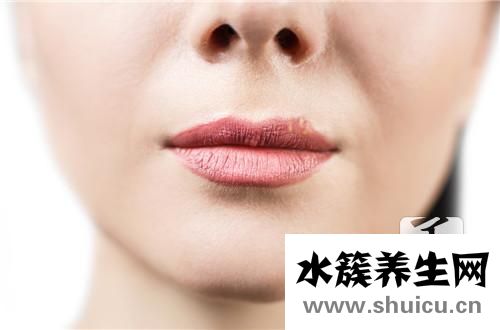 嘴巴腫了怎么消腫最快