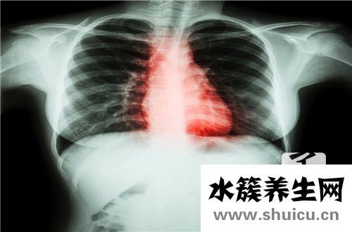 心衰癥狀
