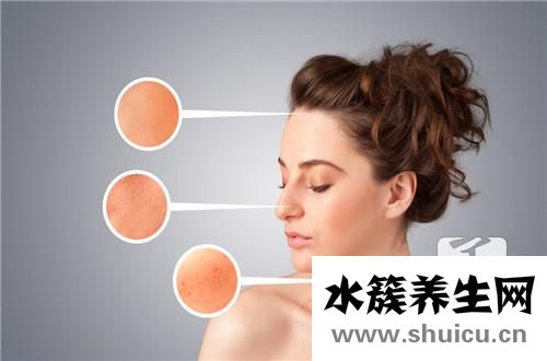 結節痤瘡