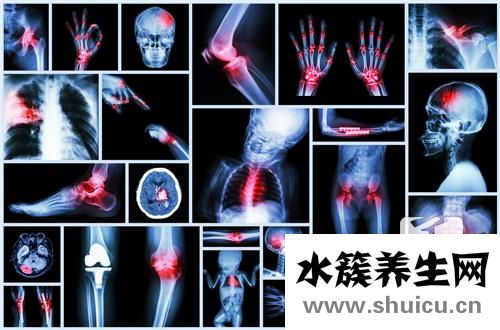 骨裂和骨折的區別