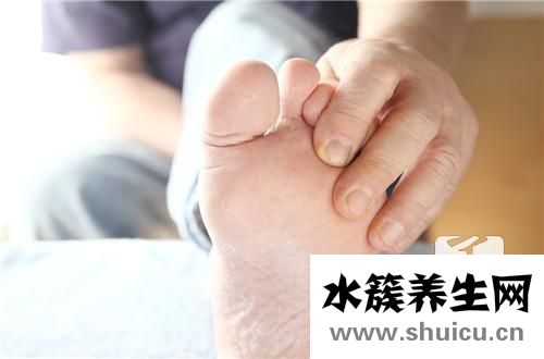 手蘚怎么治