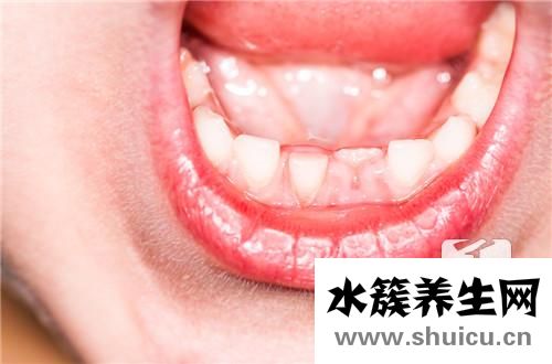 小孩牙齒沒掉又長出新牙怎么辦