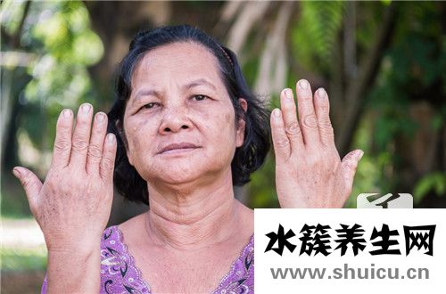 老年斑治療方法