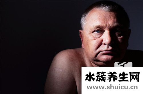 老年人貧血