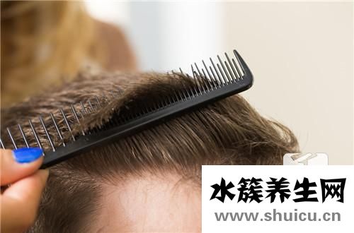 發際線高好不好