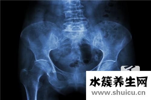 盆腔積液怎么治療最好