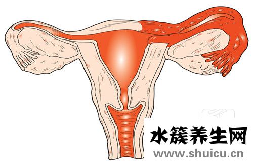 多巢囊腫