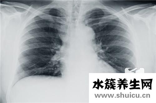 劍突疼痛