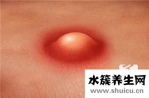鼻子長