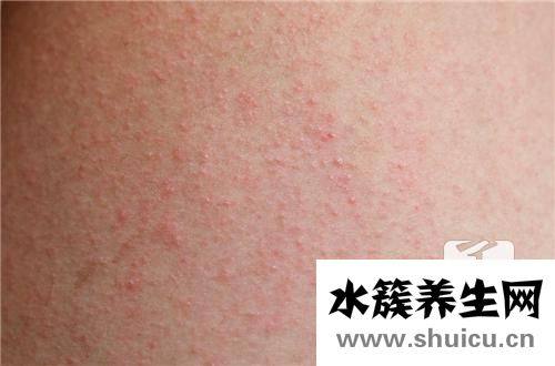 嗜酸細胞百分比偏低