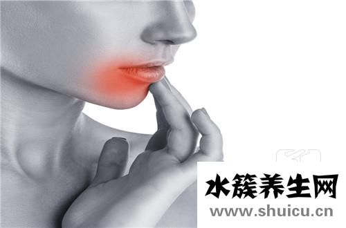 口腔粘膜炎癥狀