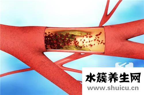 鎮痛泵副作用