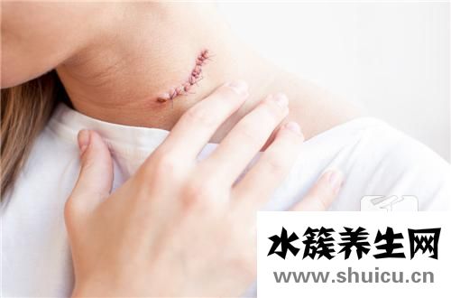 頷下腺腫瘤早期癥狀