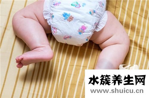 能去掉胎記