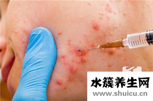 痘痘很大很硬很腫