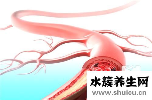 心臟血管鈣化