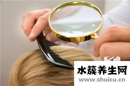頭皮癬治