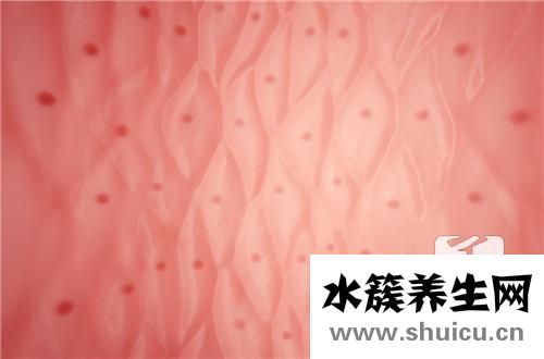 血管彩超