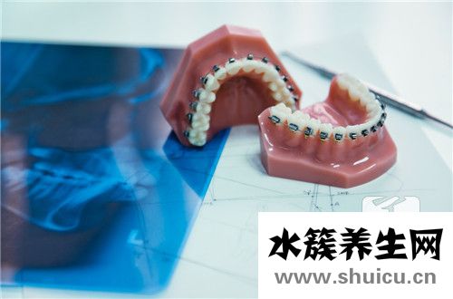 偏頜矯正