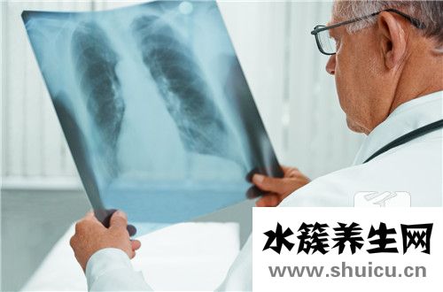 肺結核病人能活多久