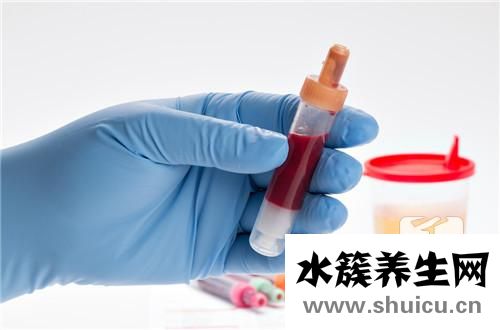 尿檢白細胞高是回事