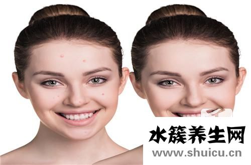 下巴長硬包按下去很痛