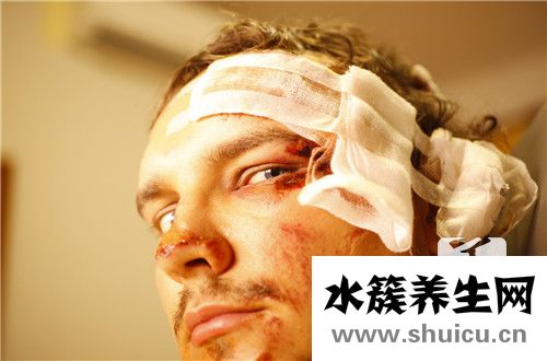 腦組織