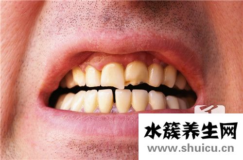 牙齒疏
