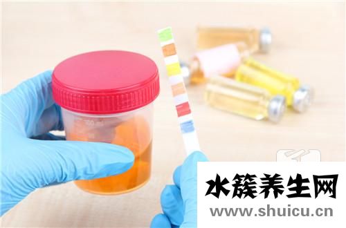 尿總蛋白