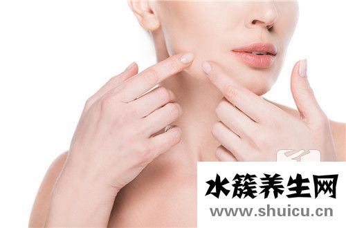 蜂窩組織