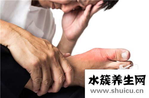 痛風查什么指標