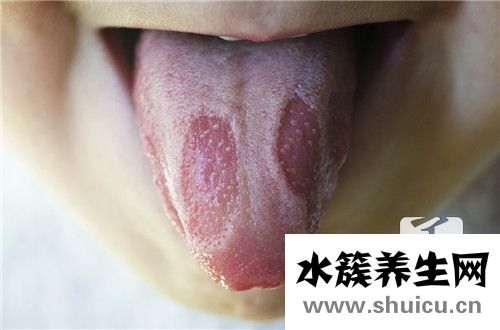 舌頭兩側發黑
