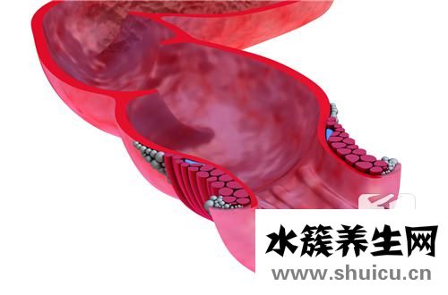 肛門狹窄