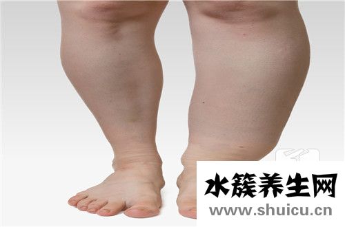 身體水腫