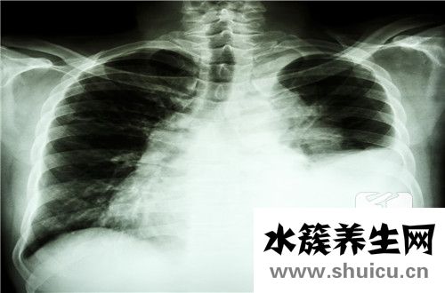 滲出液