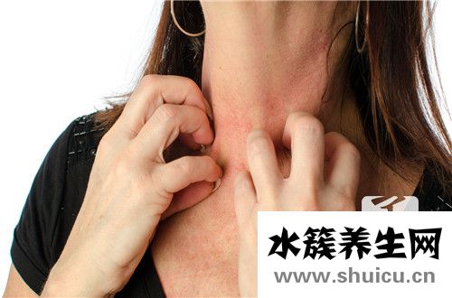 皮膚發炎
