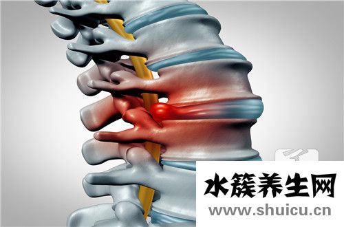 腰椎彎曲矯正