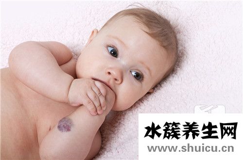 血管瘤是什么引起