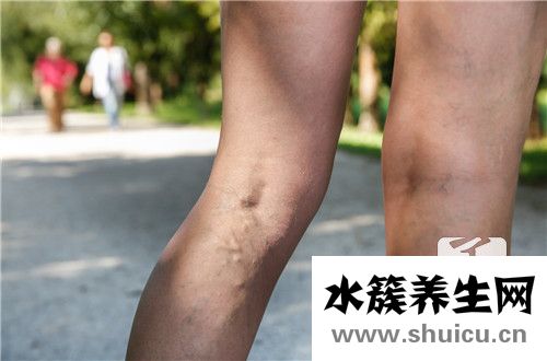 血管擴張